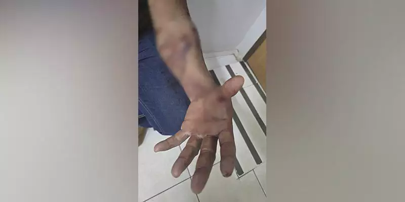 Mulher é presa suspeita de ferir marido e bebê de oito meses durante briga em Parauapebas