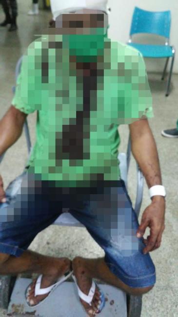 Homem é preso após espancar mulher durante crise de ciúmes