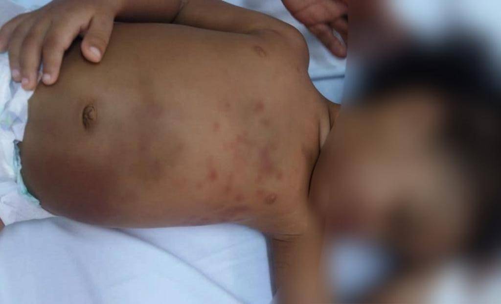 Criança passa por cirurgia às pressas, após ser agredida pela mãe