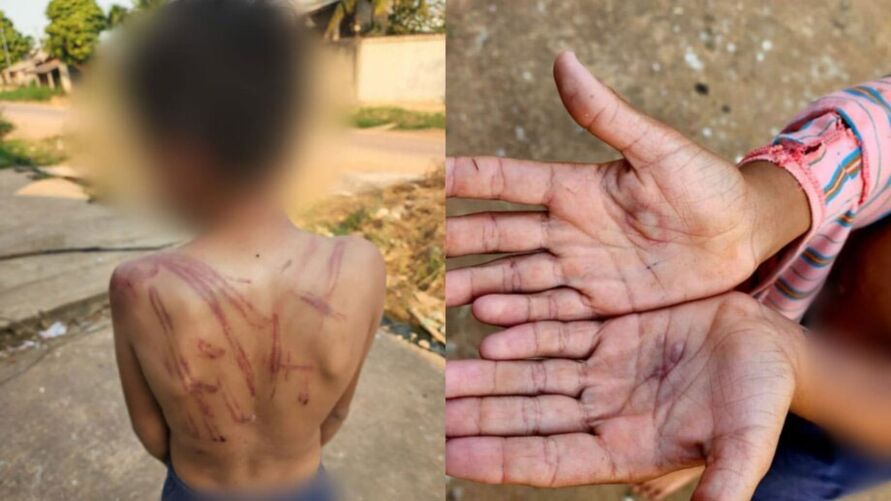 Mãe queima as mãos do filho e o espanca em Itaituba (PA)