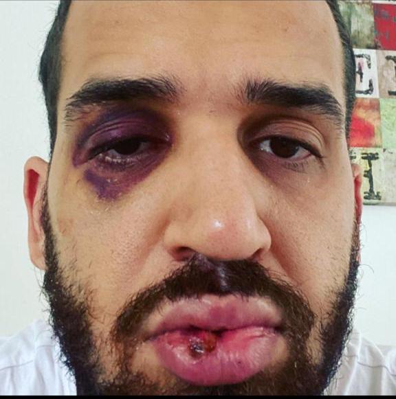 Médico é agredido por falar sobre importância de medidas restritivas contra Covid-19