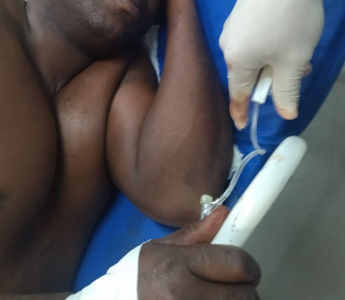 Parauapebas: criminosos tentam matar homem dentro da própria casa