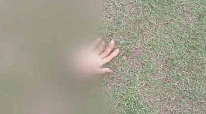 Homem tem mão decepada por causa de tatuagem em Marabá