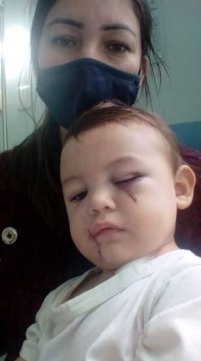 Mãe de bebê ferido em ataque mostra como ficou rosto do filho