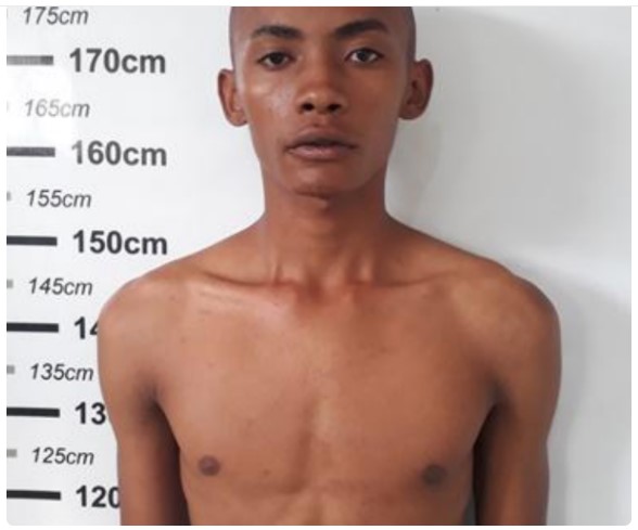 Neguinho do 15 leva a pior em confronto com a PM