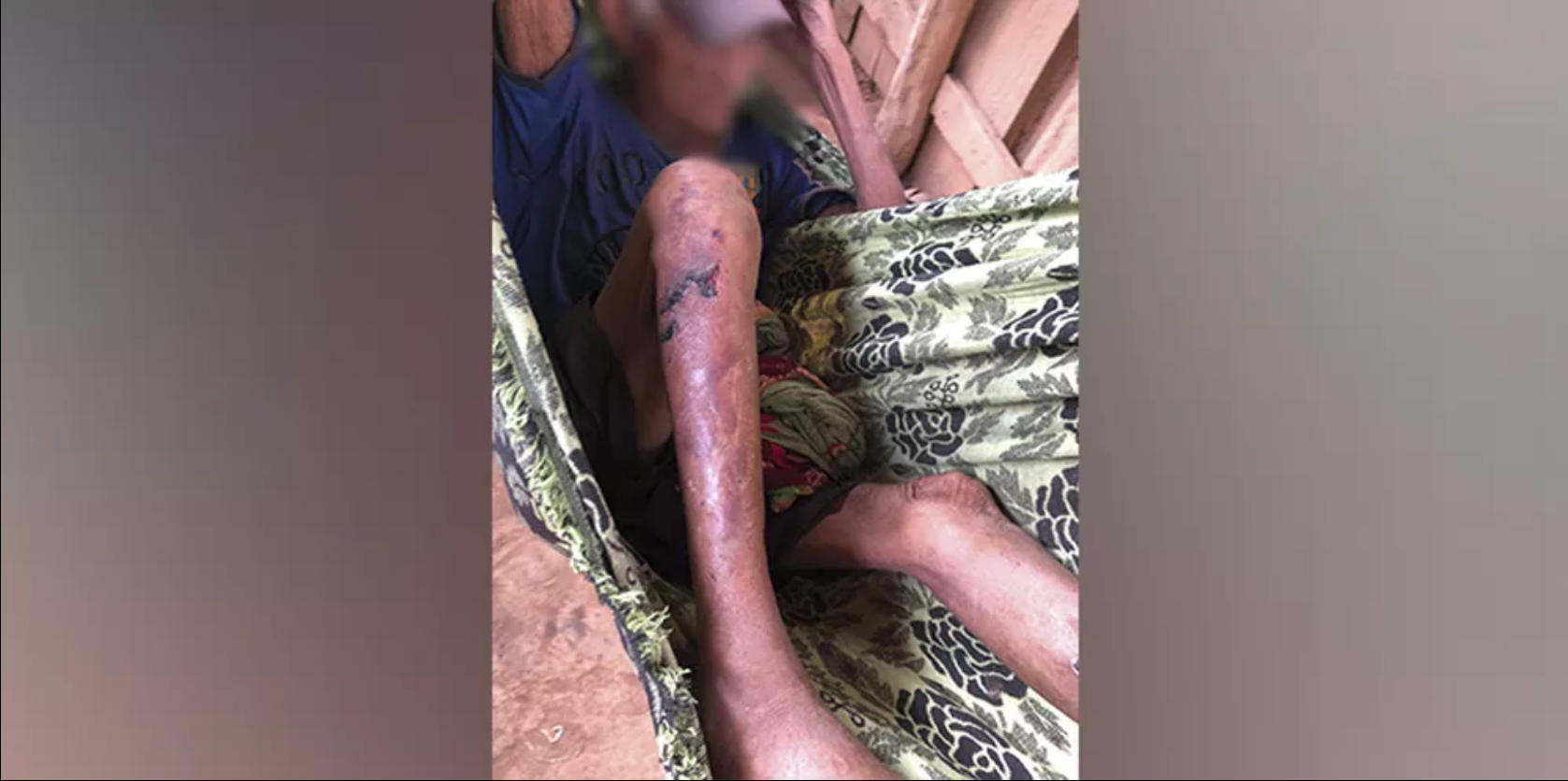 Idoso abandonado em situação precária é resgatado pela Polícia no interior do Pará