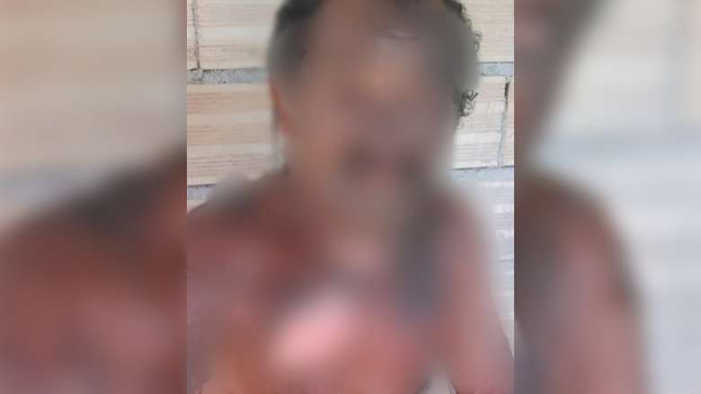Mulher joga óleo quente em marido após sofrer agressões no Pará