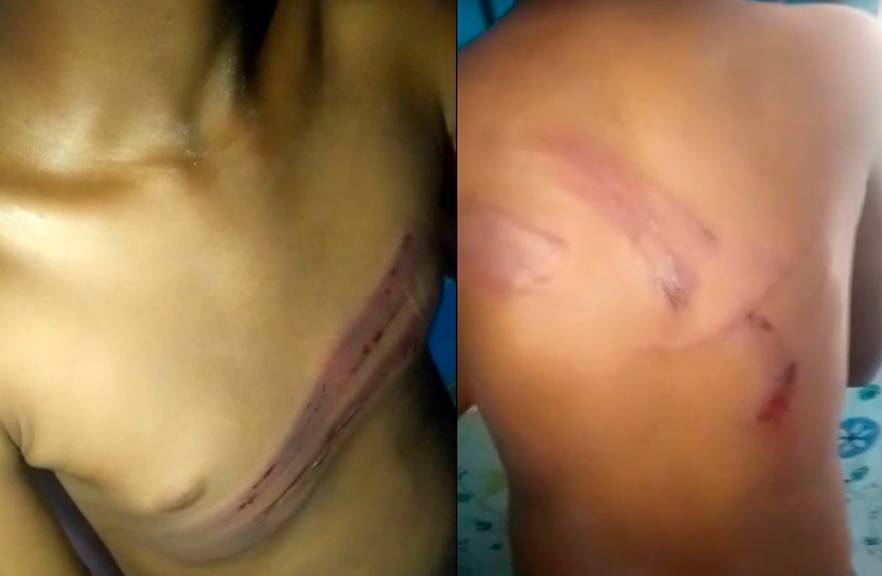Pai espanca o filho e dá banho de sal nas feridas