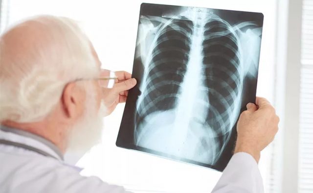 Tuberculose doença tratável mas que pode matar