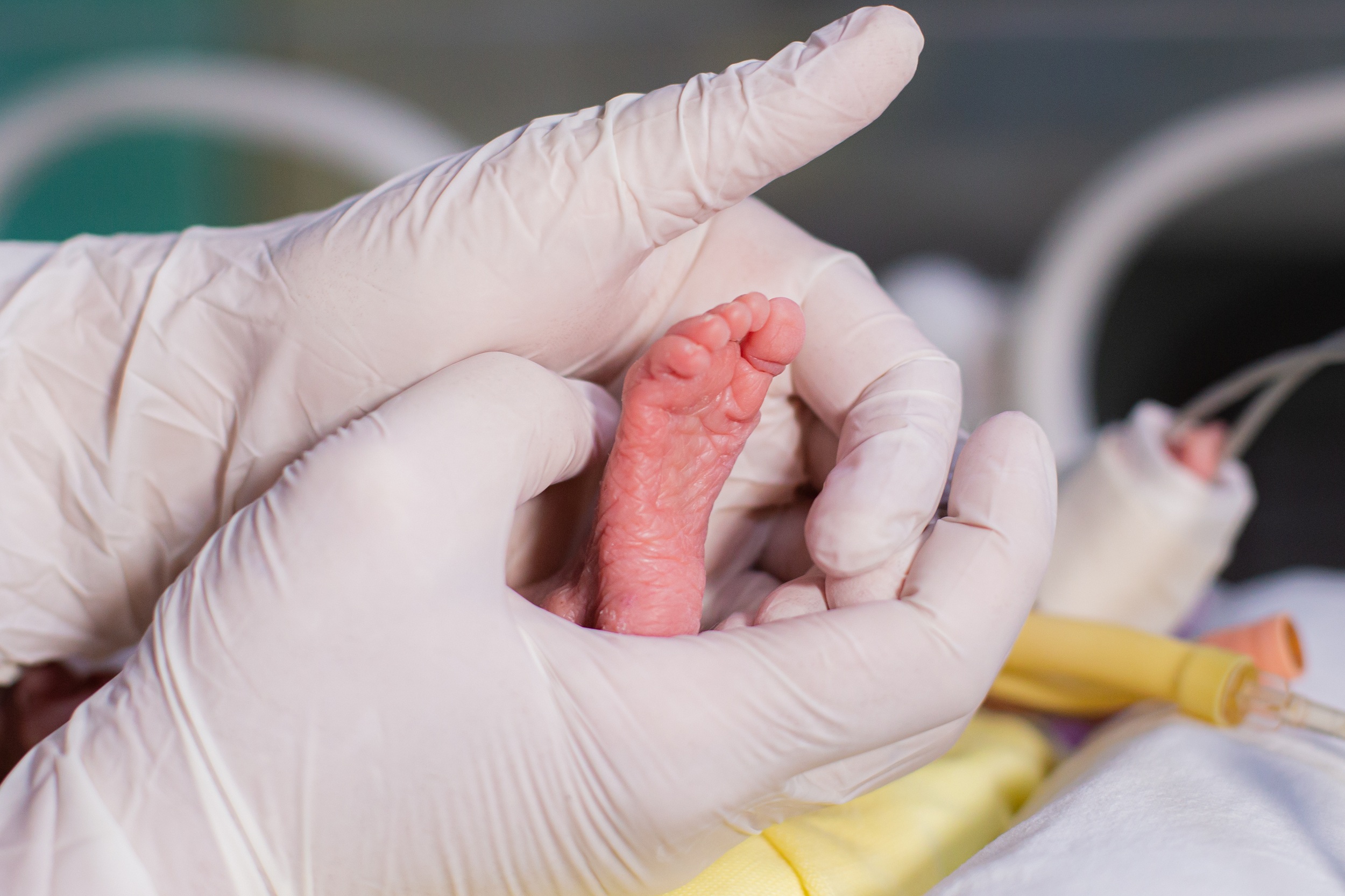 Hospital Regional de Marabá é refúgio de esperança para bebês prematuros