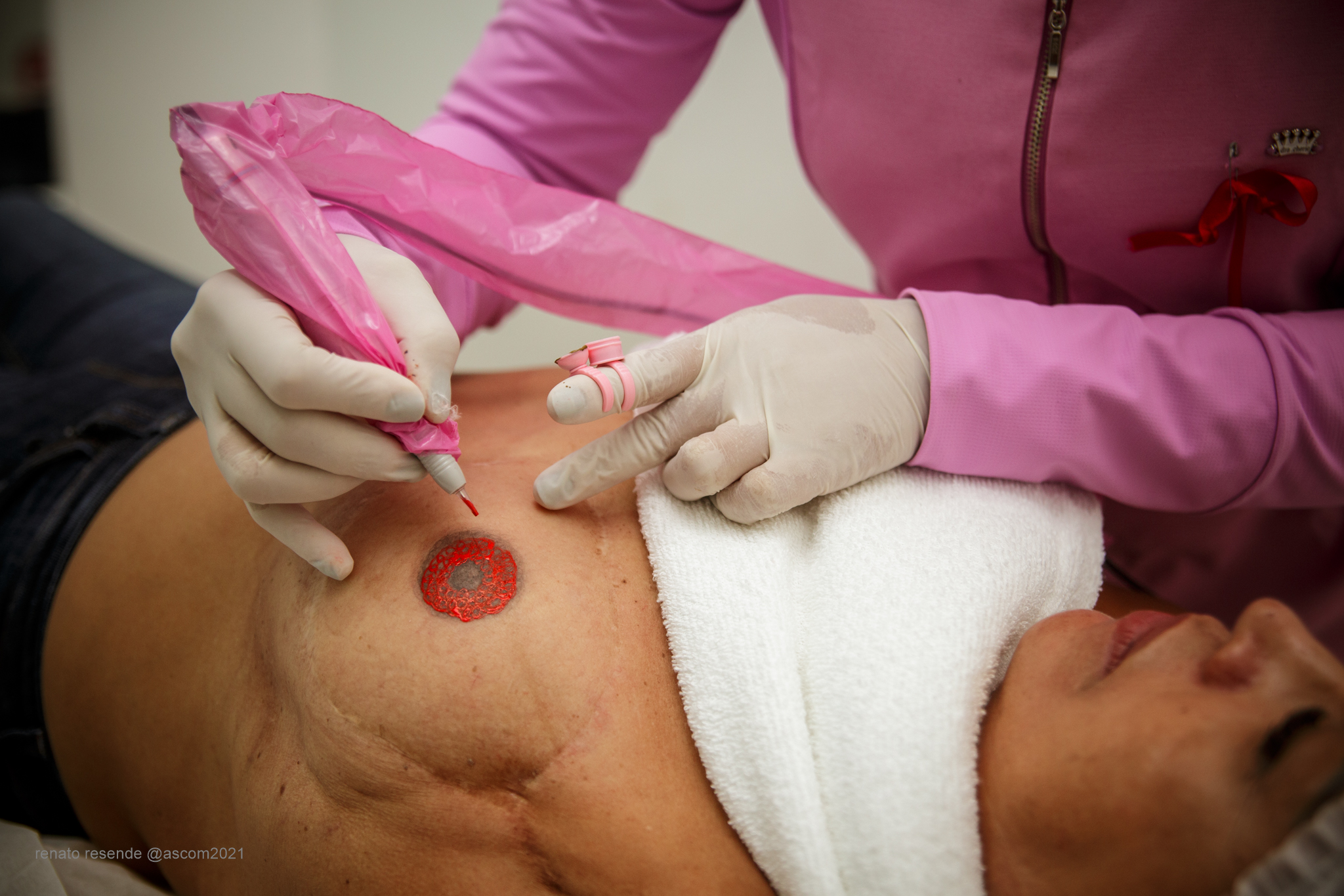 Projeto ajuda a resgatar a autoestima de mulheres vítimas do câncer de mama