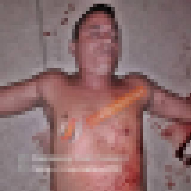 Homem é morto pelo próprio irmão com tiro no peito