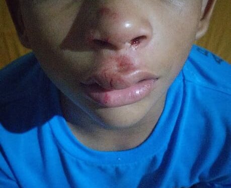 Grupo de crianças espancam menino de 9 anos em Canaã dos Carajás