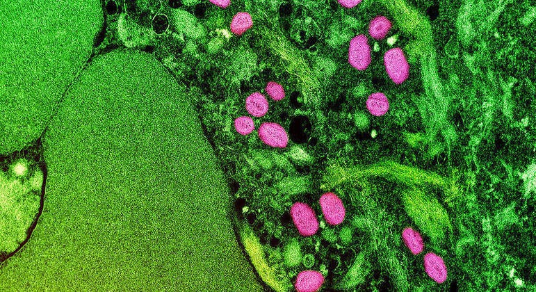 Vírus da varíola do macaco é encontrado em saliva e sêmen de infectados