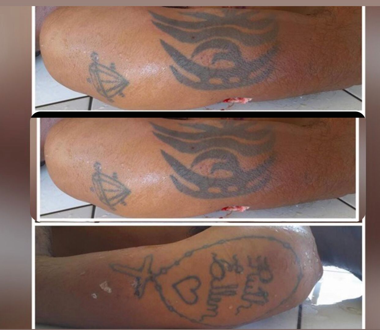 Corpo ainda não identificado é encontrado em Tucumã