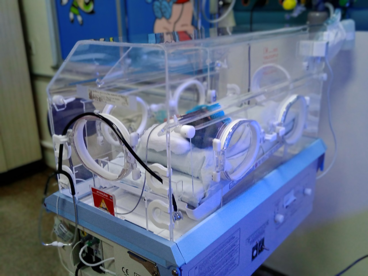 Incubadoras e berços aquecidos são fundamentais na recuperação de bebês em Marabá