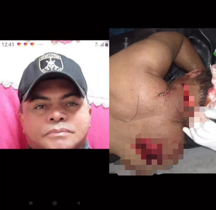 Eldorado; Homem sofre tentativa de homicídio após dar carona para desconhecido