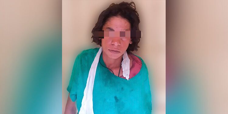 Mulher é presa roubando alimentos em hospital