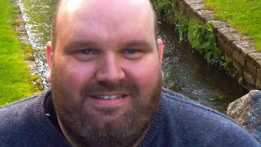 Homem ganha R$ 1,9 milhão amputando partes do corpo em vídeos na web