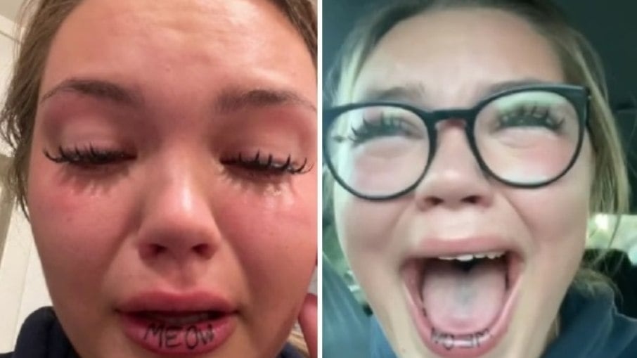 Mulher que tatuou “miau” no lábio está irreconhecível