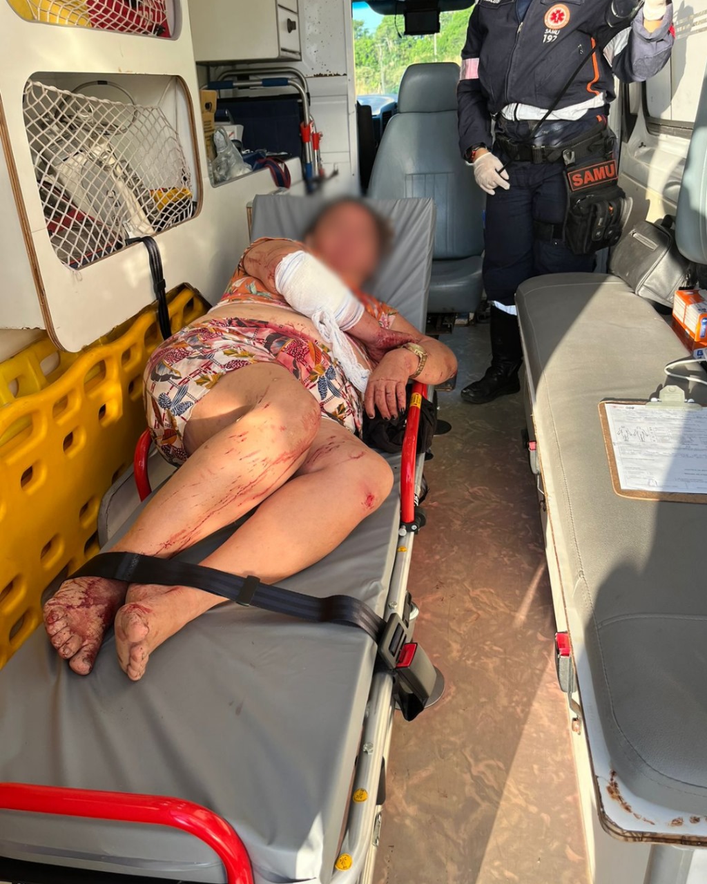 Mulher é esfaqueada durante assalto