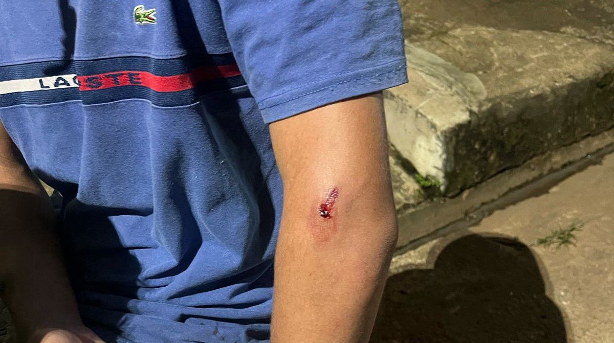 Dois homens chegam de moto e tentam matar jovem em Parauapebas