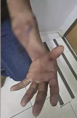 Mulher é presa suspeita de ferir marido e bebê de oito meses, em Parauapebas