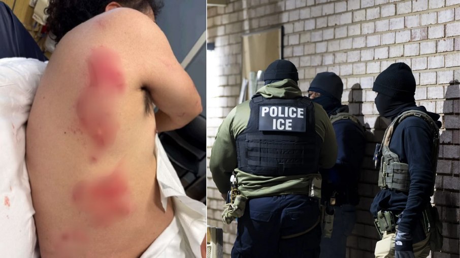 Agentes dos EUA teriam usado cão para atacar e deter imigrante