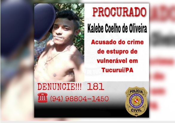 Procurado; Homem acusado de abusar de criança de 3 anos