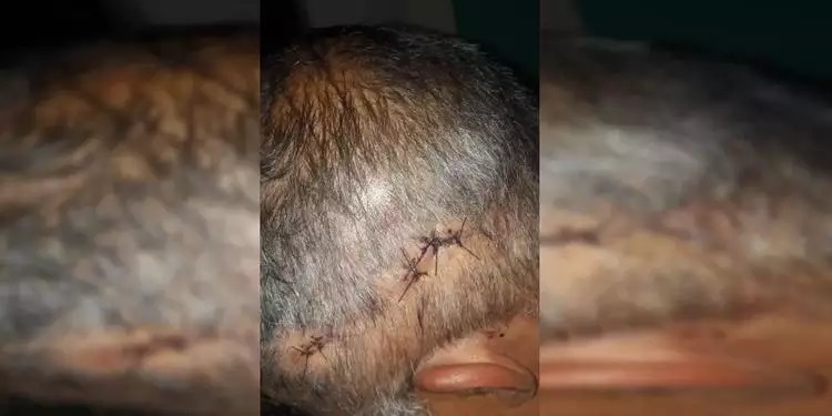 Homem é atacado com 4 facadas na cabeça após negar esmola de 1 real