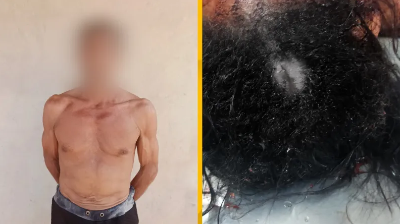 Homem é preso acusado de agredir a companheira na cabeça em Tailândia