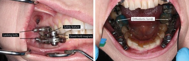 Aparelho bizarro promete ajudar no emagrecimento