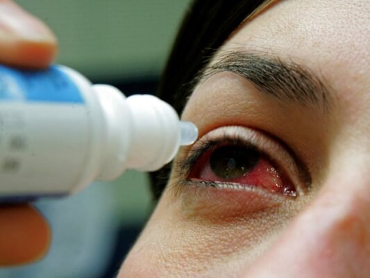 Regional de Marabá alerta para incidência de doenças oculares no período de chuvas