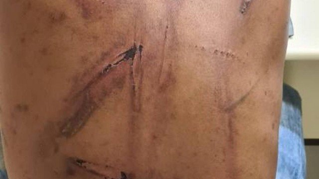 Polícia prende suspeito de torturar homem que tentava largar o vício das drogas