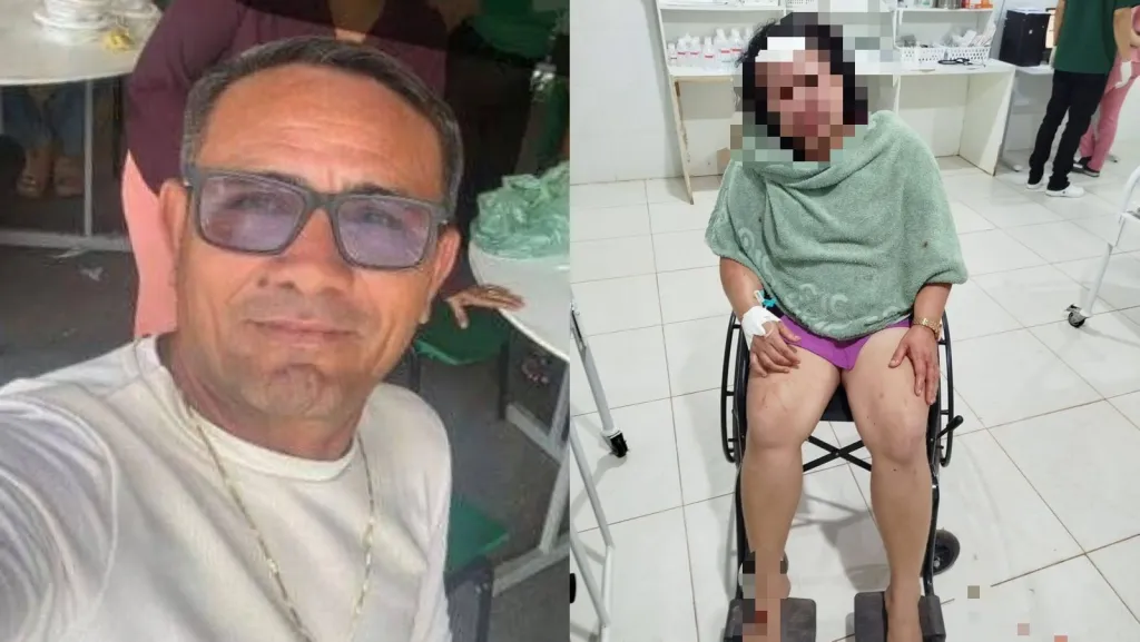 Violência doméstica em Moju: mulher é brutalmente agredida por ex-companheiro e suspeito está foragido
