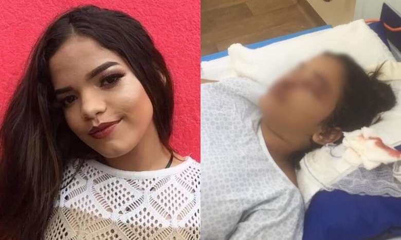 Vídeo: jovem leva ‘tijolada’ no rosto e família pede ajuda para o tratamento