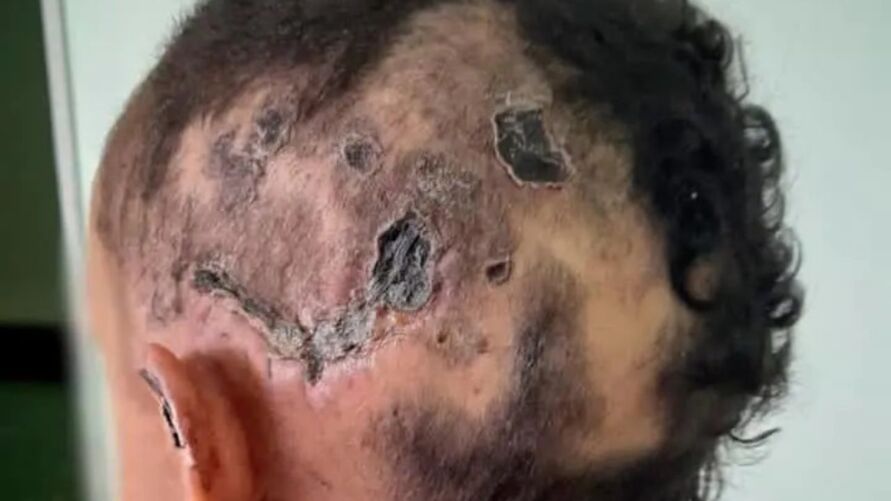 Mulher é torturada por traficante para “servir como exemplo”