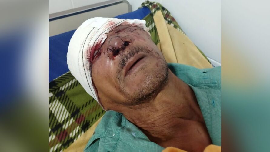 Idoso luta com onça no Marajó e fica com rosto desfigurado