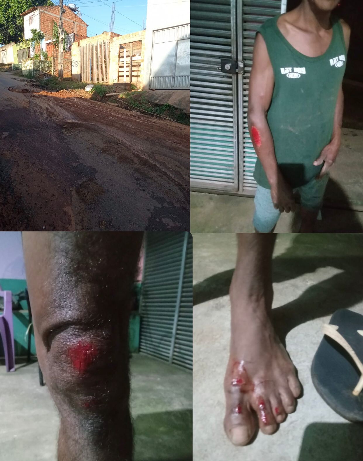 Parauapebas buraco na Rua São Francisco causa acidentes