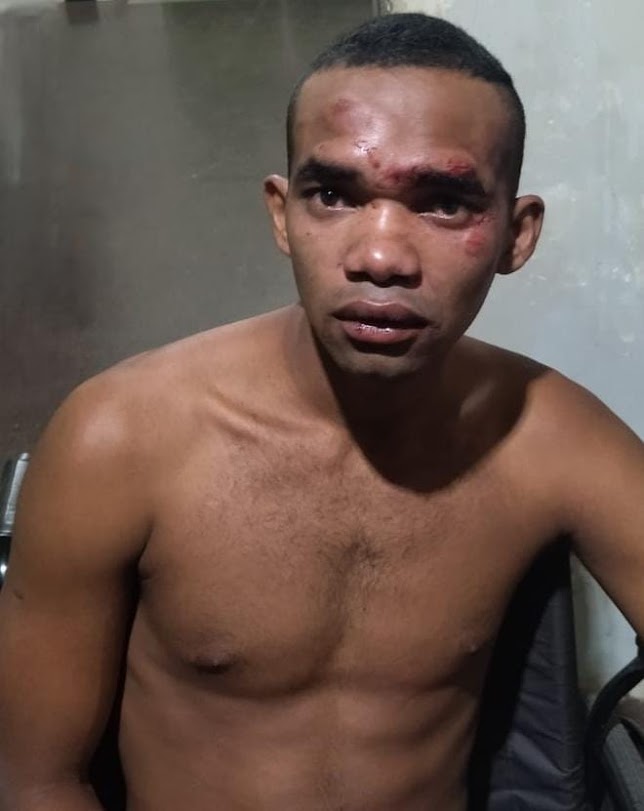 Homem é baleado por policial militar após tentar assaltar loja com um facão em Parauapebas