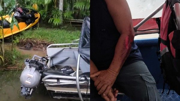 Belém: Ribeirinho é atingido por moto aquática na Ilha do Combu
