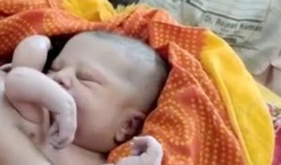 Vídeo: Bebê nasce com 4 braços e 4 pernas e é chamado de Deus