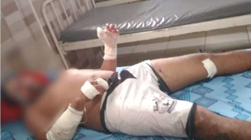 homem foi atacado por Pitbull mata animal ao ser defender, no PA
