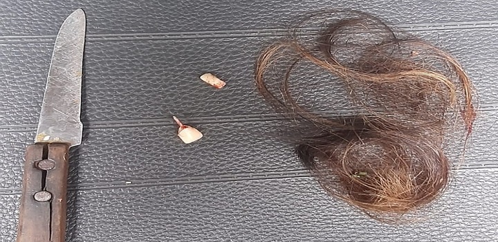 Mulher tem cabelo cortado, dois dentes quebrados e fica mantida em cárcere por nove horas